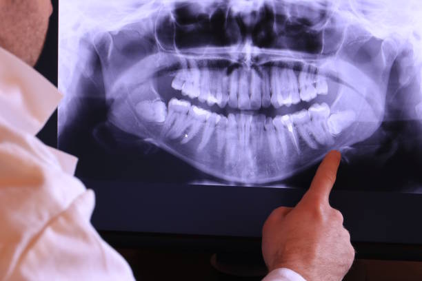 Best Root Canal Emergency Dentist  in Iceville, AL