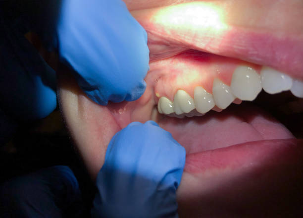 Best Tooth Pain Emergency Relief  in Iceville, AL