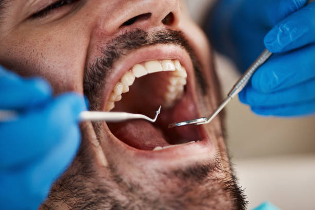 Best Dentist for Tooth Abscess  in Iceville, AL